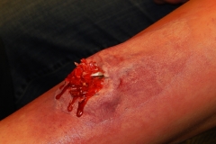 aufbaukurs-2014-I-1-Hilfe_100