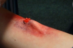 aufbaukurs-2015-I-erste-Hilfe_108