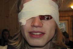 aufbaukurs-2016-I-erste-hilfe_064