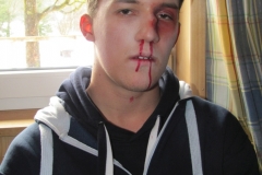 aufbaukurs-2016-I-erste-hilfe_117