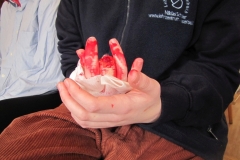 aufbaukurs-2016-I-erste-hilfe_118